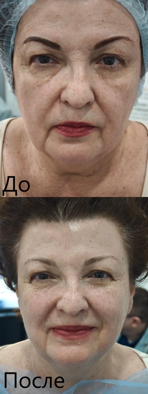 Шарм 7
